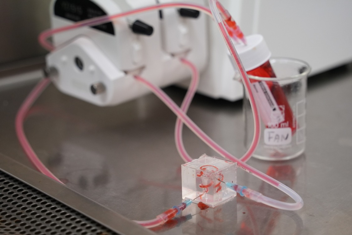 香港大学李嘉诚医学院研发全球首个“仿生肝立方：肝癌和肝病的全面精准诊疗平台”