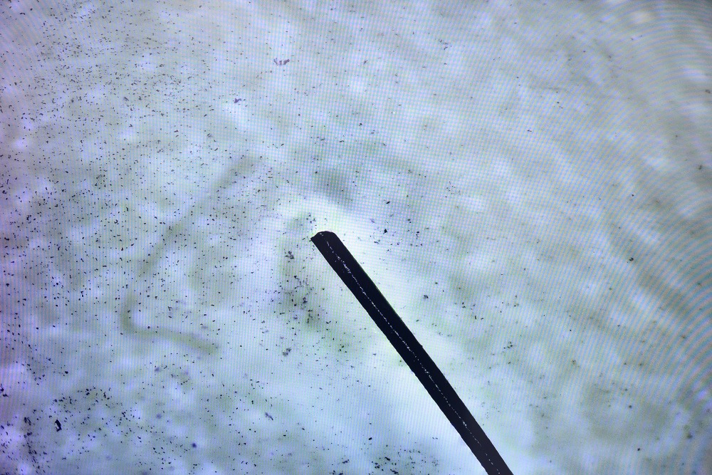 人類頭髮與納米機械人（黑點）的比例